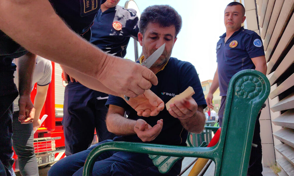 Bursa'da Mobilya Işçisinin Kazara Parmağına Çaktığı Çivi, Hastanede Çıkarıldı (2)